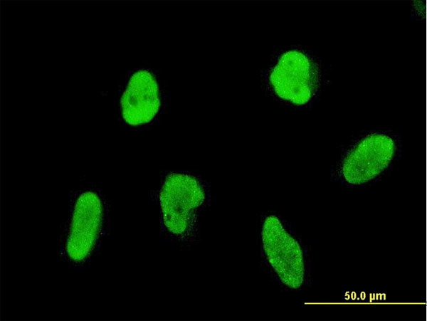 FLI1 Antibody in Immunocytochemistry (ICC/IF)
