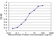 FMR1 Antibody in ELISA (ELISA)