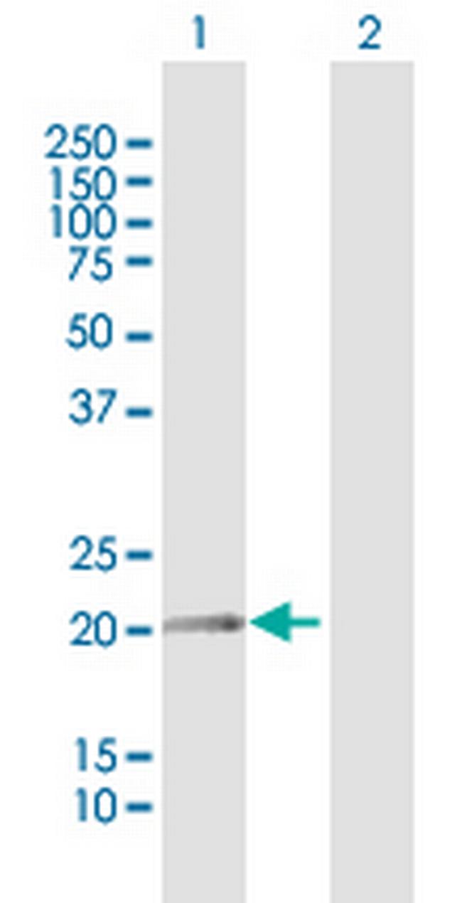 FN1 Antibody in Western Blot (WB)