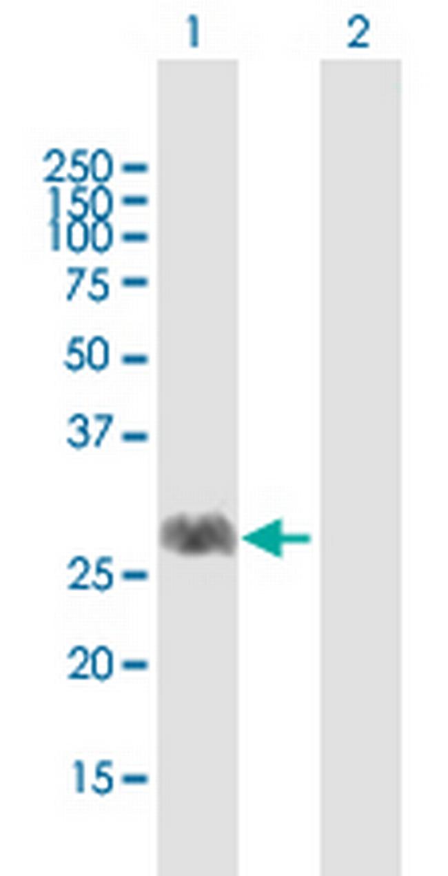 FNTA Antibody in Western Blot (WB)