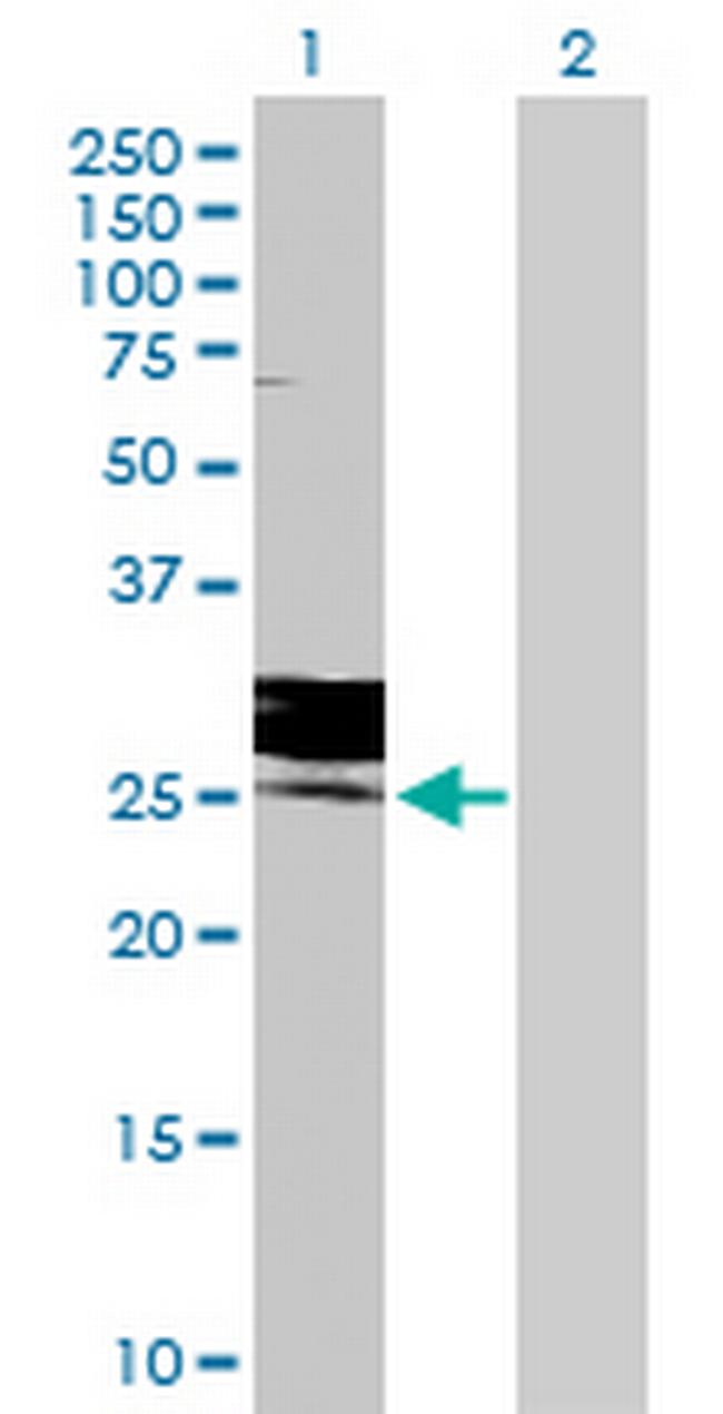 FOLR3 Antibody in Western Blot (WB)