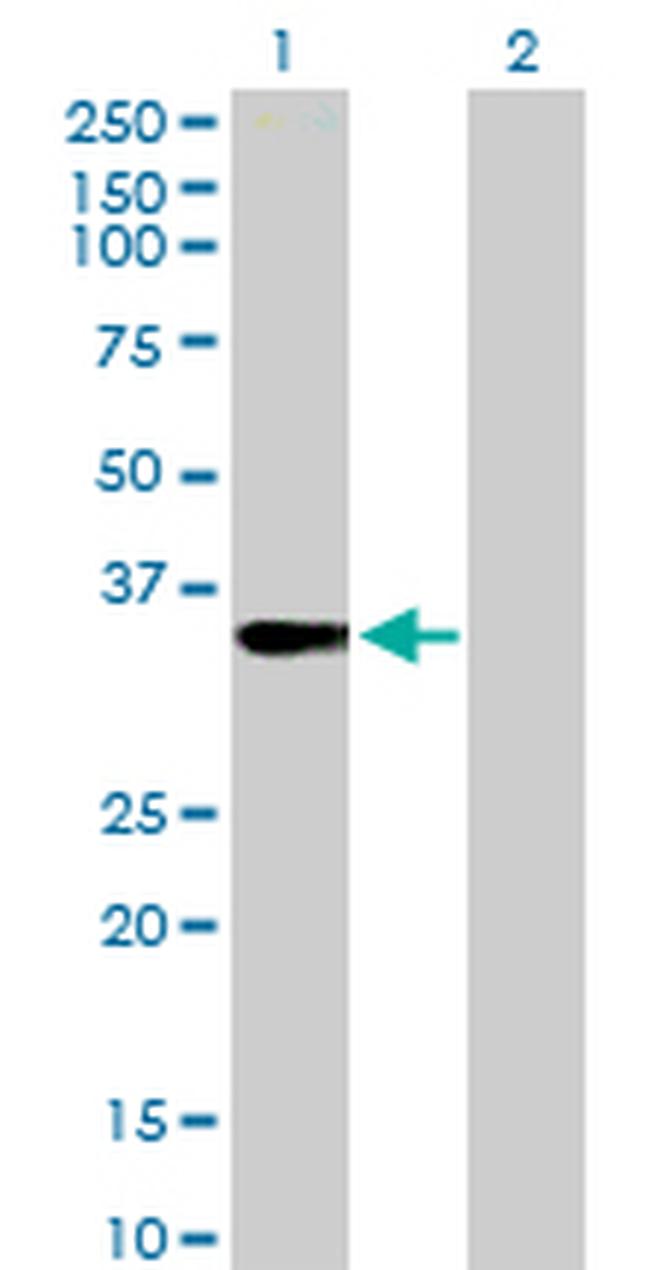 FRG1 Antibody in Western Blot (WB)