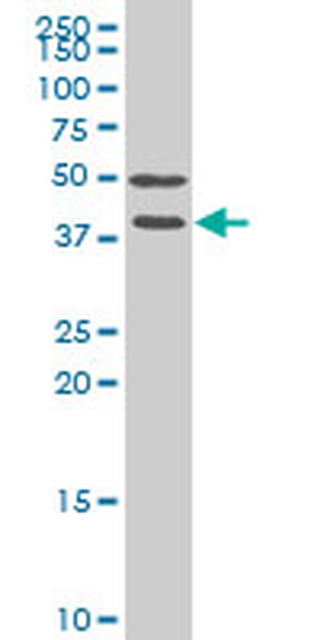 FRZB Antibody in Western Blot (WB)