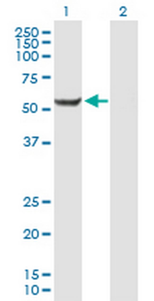 CENPI Antibody in Western Blot (WB)