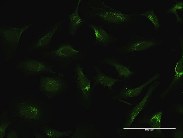 FTL Antibody in Immunocytochemistry (ICC/IF)