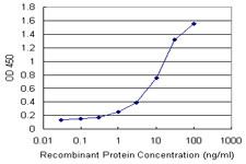 FTL Antibody in ELISA (ELISA)