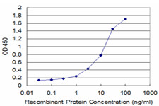 FTL Antibody in ELISA (ELISA)
