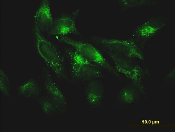 FTL Antibody in Immunocytochemistry (ICC/IF)
