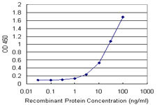 FTL Antibody in ELISA (ELISA)