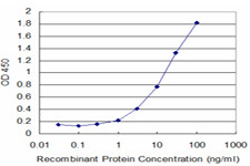 FTL Antibody in ELISA (ELISA)