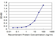 FTL Antibody in ELISA (ELISA)