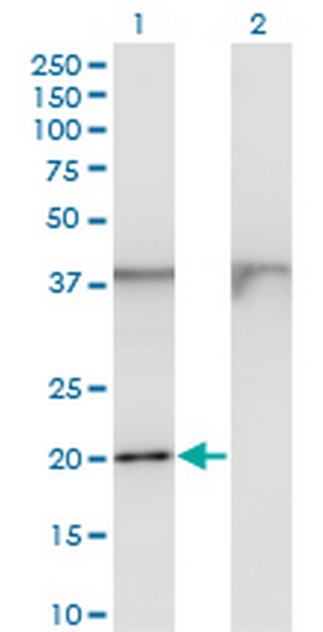 FTL Antibody in Western Blot (WB)