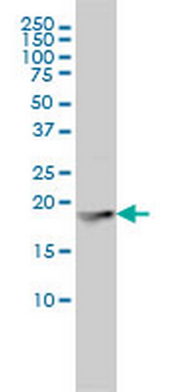 FTL Antibody in Western Blot (WB)