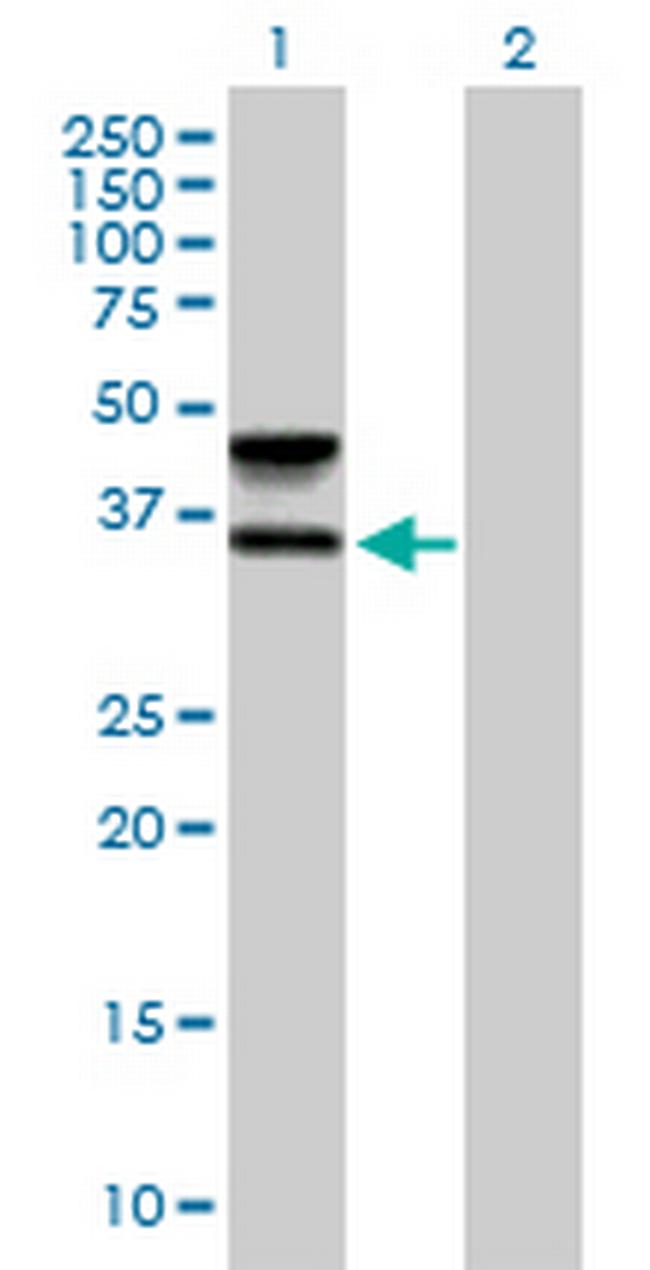 FUT6 Antibody in Western Blot (WB)