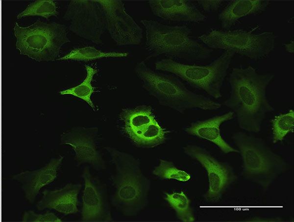 G6PD Antibody in Immunocytochemistry (ICC/IF)