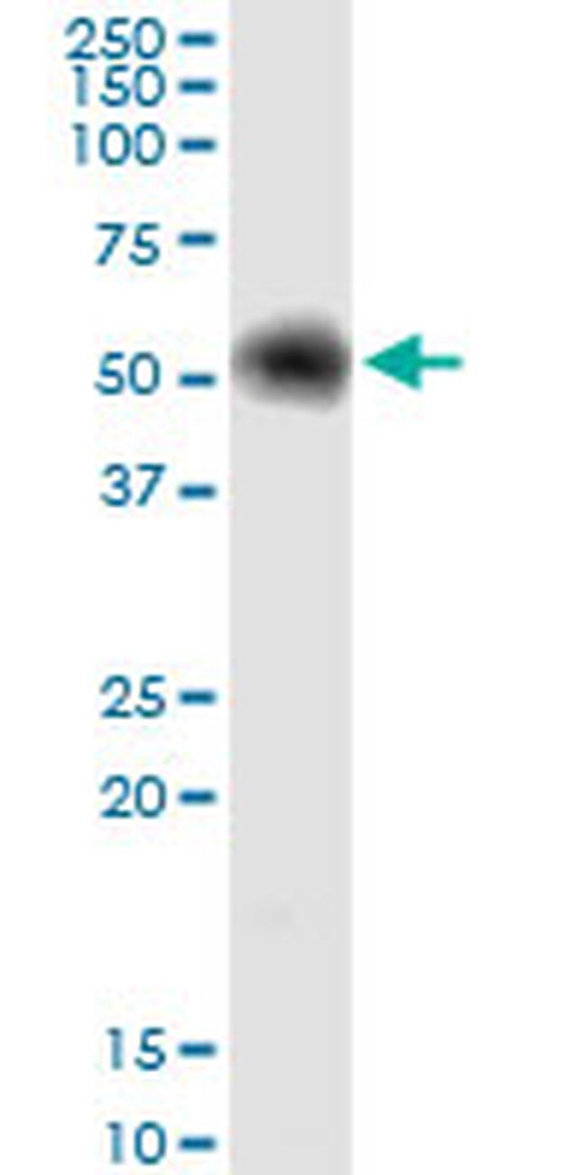 G6PD Antibody in Western Blot (WB)