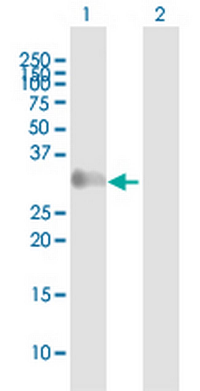 GAGE1 Antibody in Western Blot (WB)