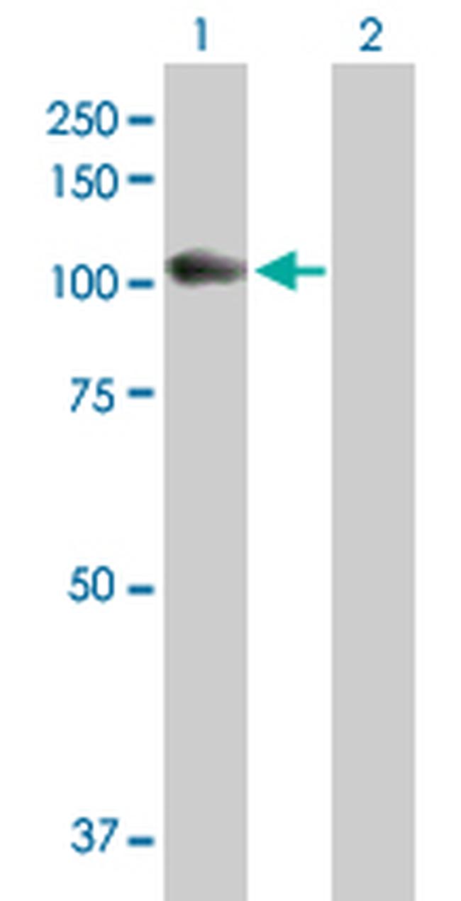 GAA Antibody in Western Blot (WB)