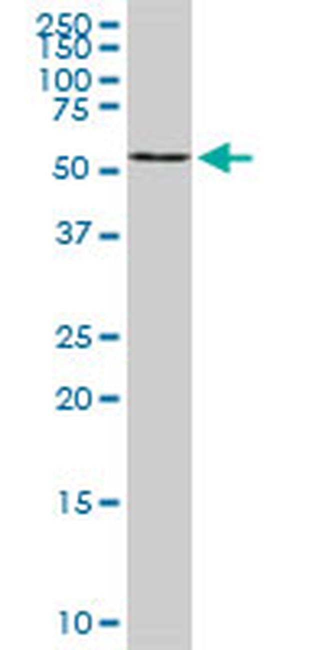 B4GALNT1 Antibody in Western Blot (WB)