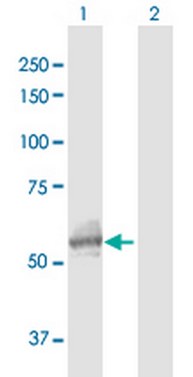 GALNS Antibody in Western Blot (WB)