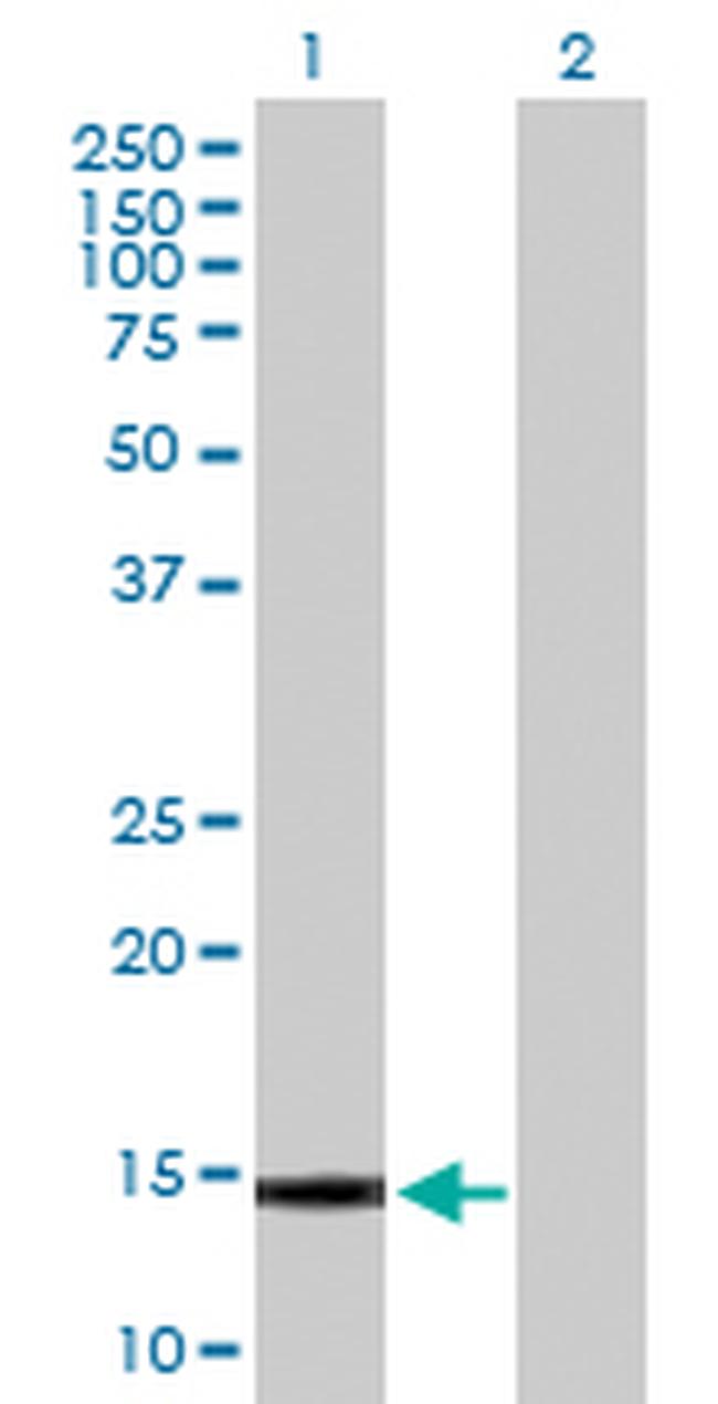 GALNT1 Antibody in Western Blot (WB)