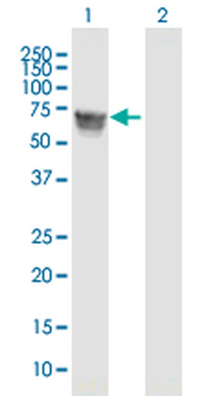 GBA Antibody in Western Blot (WB)