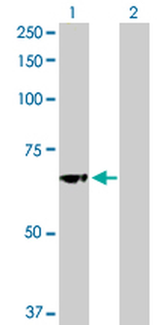 GBA Antibody in Western Blot (WB)