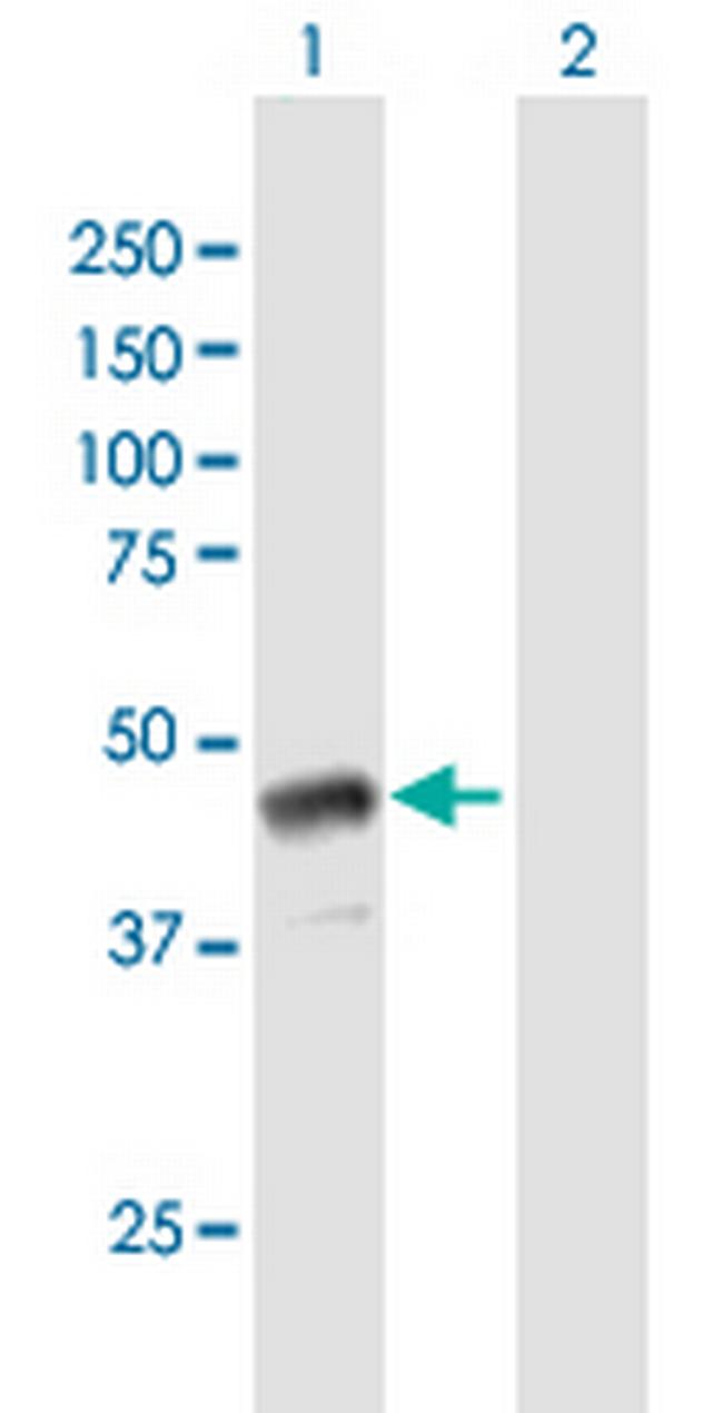 GBX1 Antibody in Western Blot (WB)