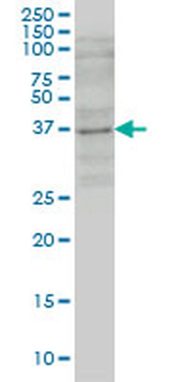 GBX2 Antibody in Western Blot (WB)