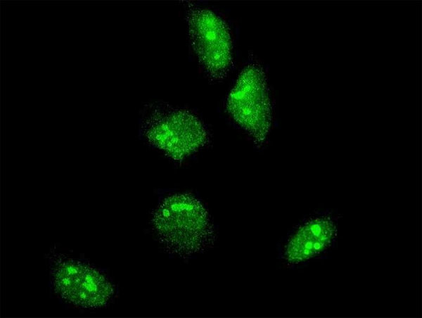 GBX2 Antibody in Immunocytochemistry (ICC/IF)