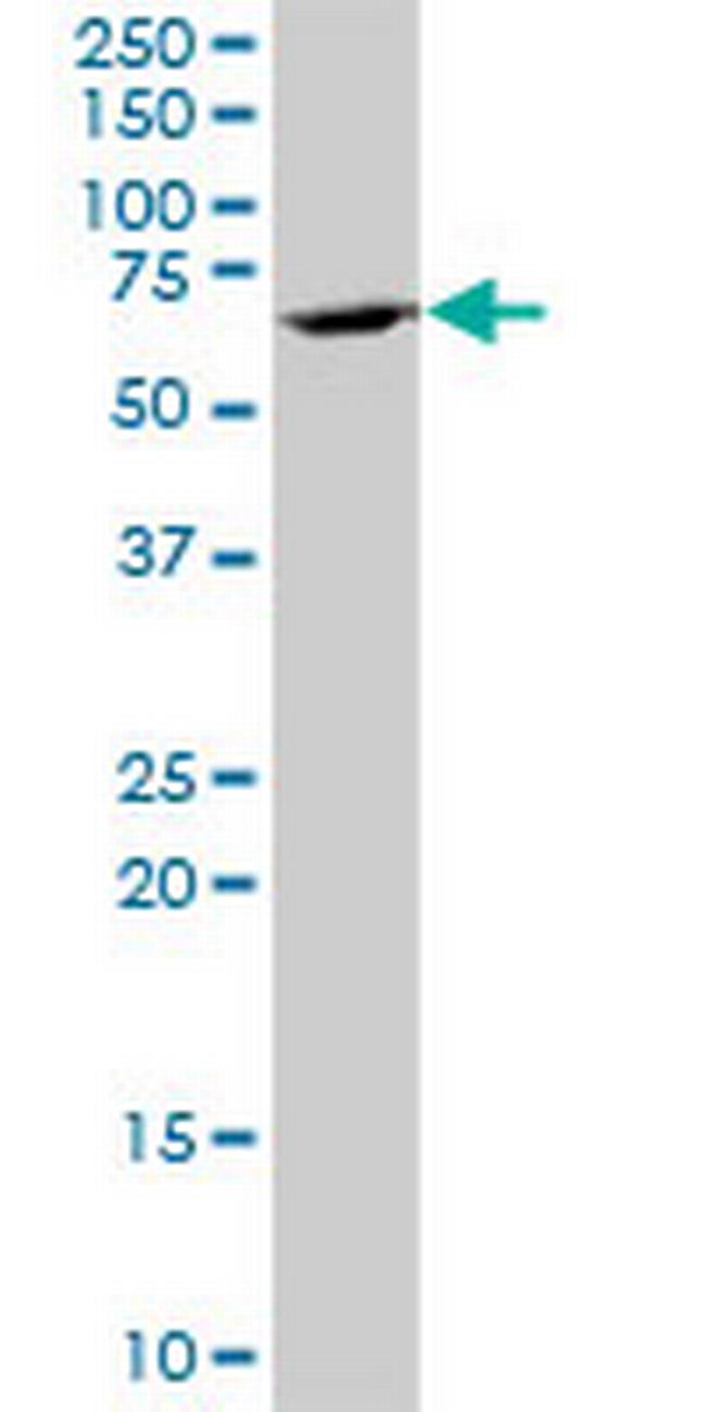 GC Antibody in Western Blot (WB)