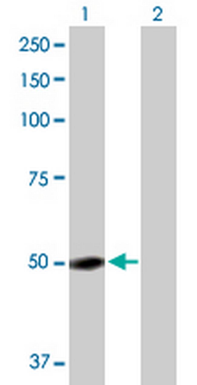 GC Antibody in Western Blot (WB)