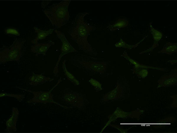 GCHFR Antibody in Immunocytochemistry (ICC/IF)
