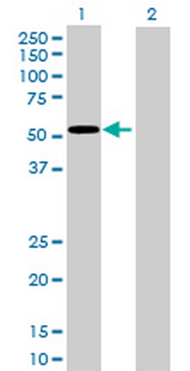 GCK Antibody in Western Blot (WB)