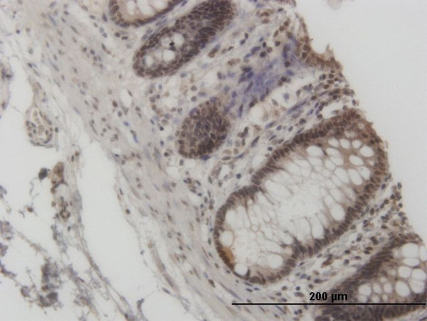 GCN5L2 Antibody in Immunohistochemistry (Paraffin) (IHC (P))