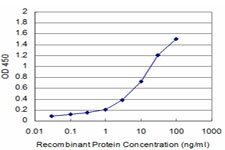 GCSH Antibody in ELISA (ELISA)