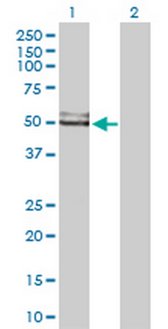 GDI1 Antibody in Western Blot (WB)