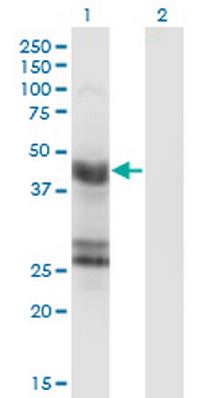 GFAP Antibody in Western Blot (WB)