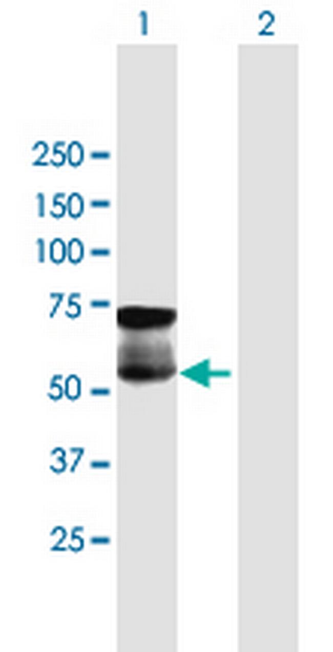 GGT1 Antibody in Western Blot (WB)