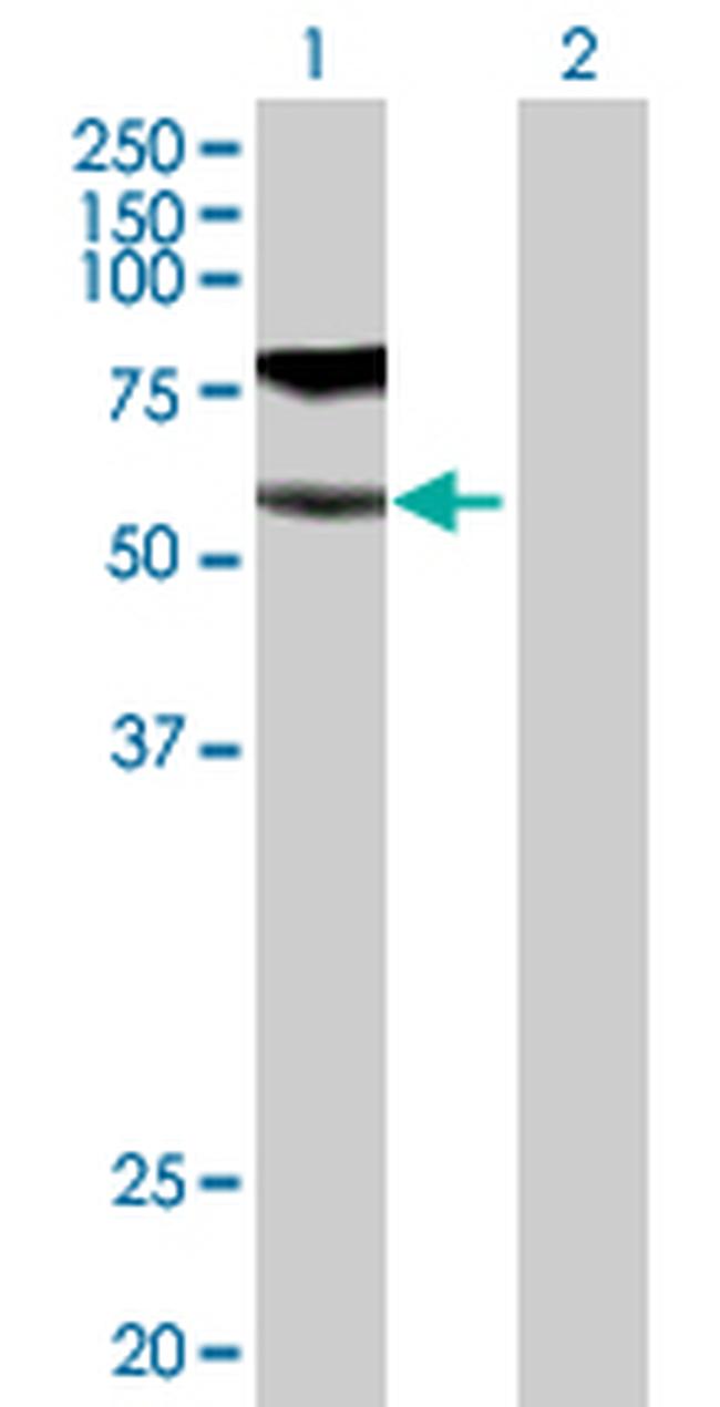 GGT1 Antibody in Western Blot (WB)