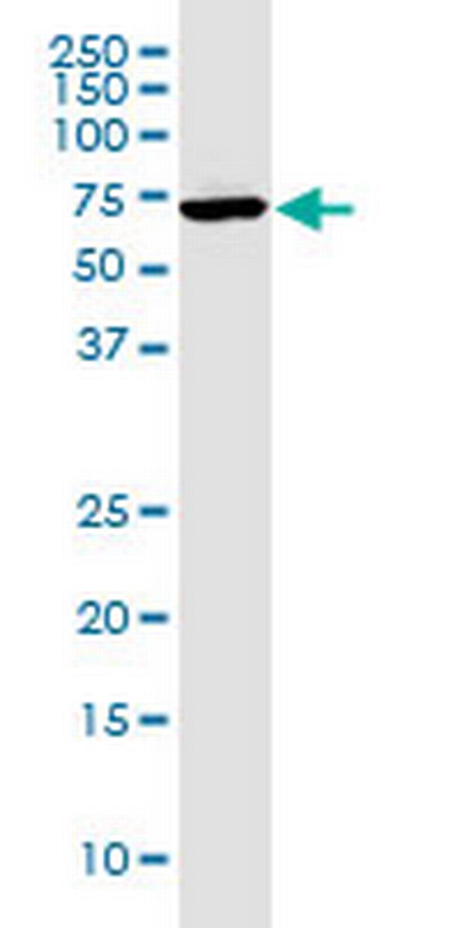 GGT1 Antibody in Western Blot (WB)