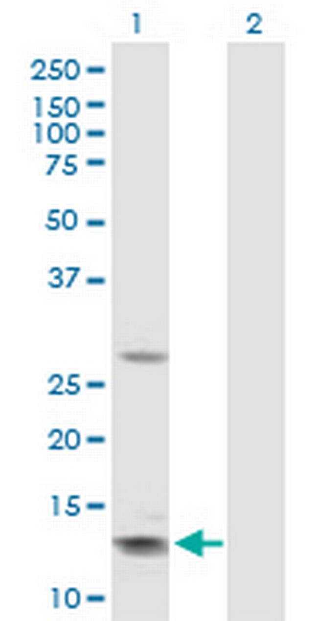 GHRH Antibody in Western Blot (WB)