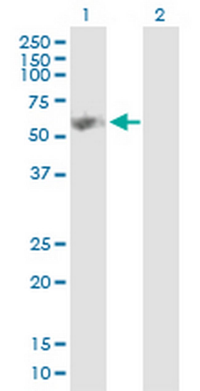 GK Antibody in Western Blot (WB)
