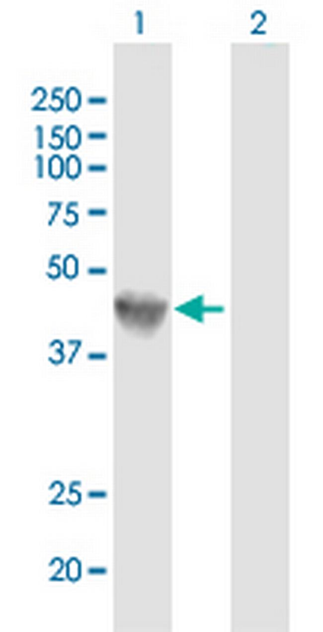 GLA Antibody in Western Blot (WB)