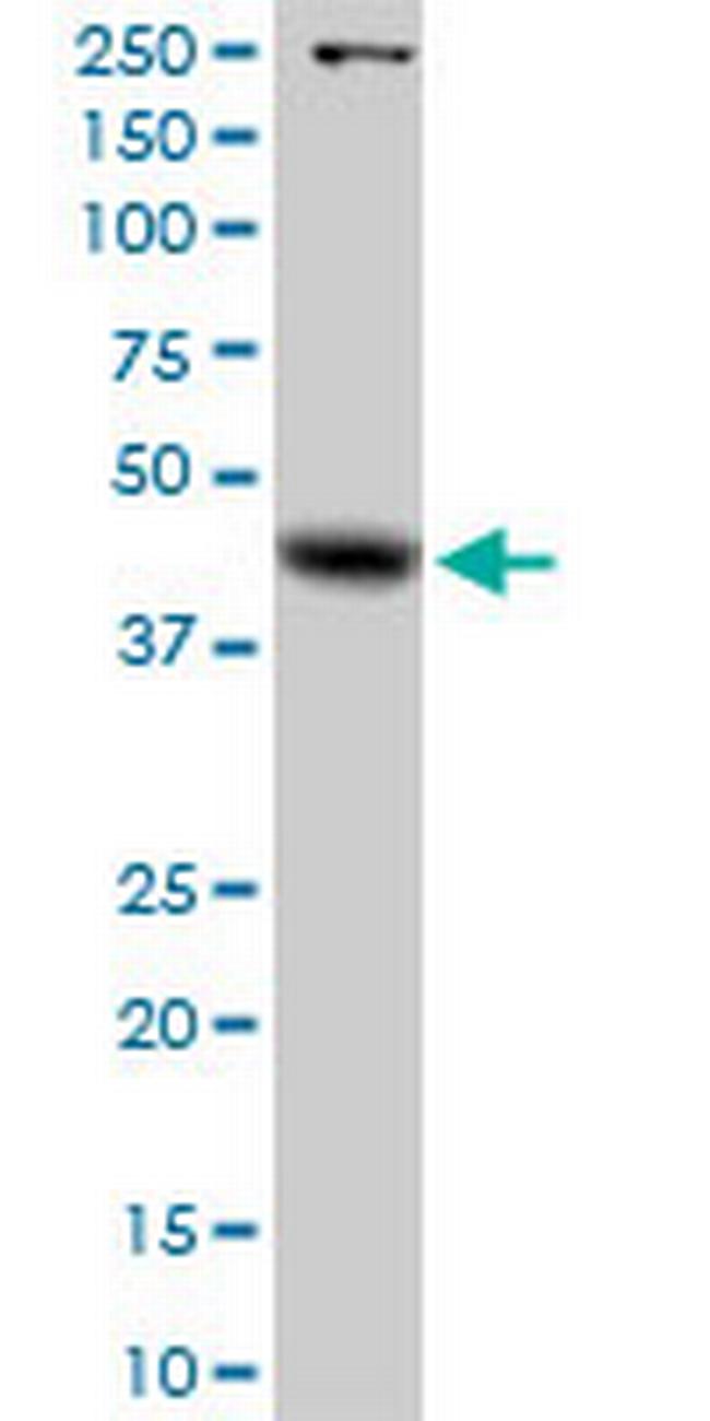 GLA Antibody in Western Blot (WB)