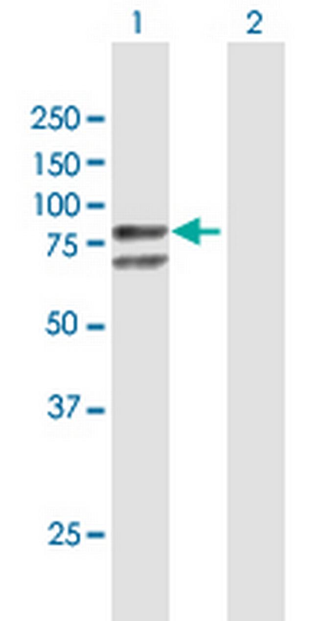 GLB1 Antibody in Western Blot (WB)
