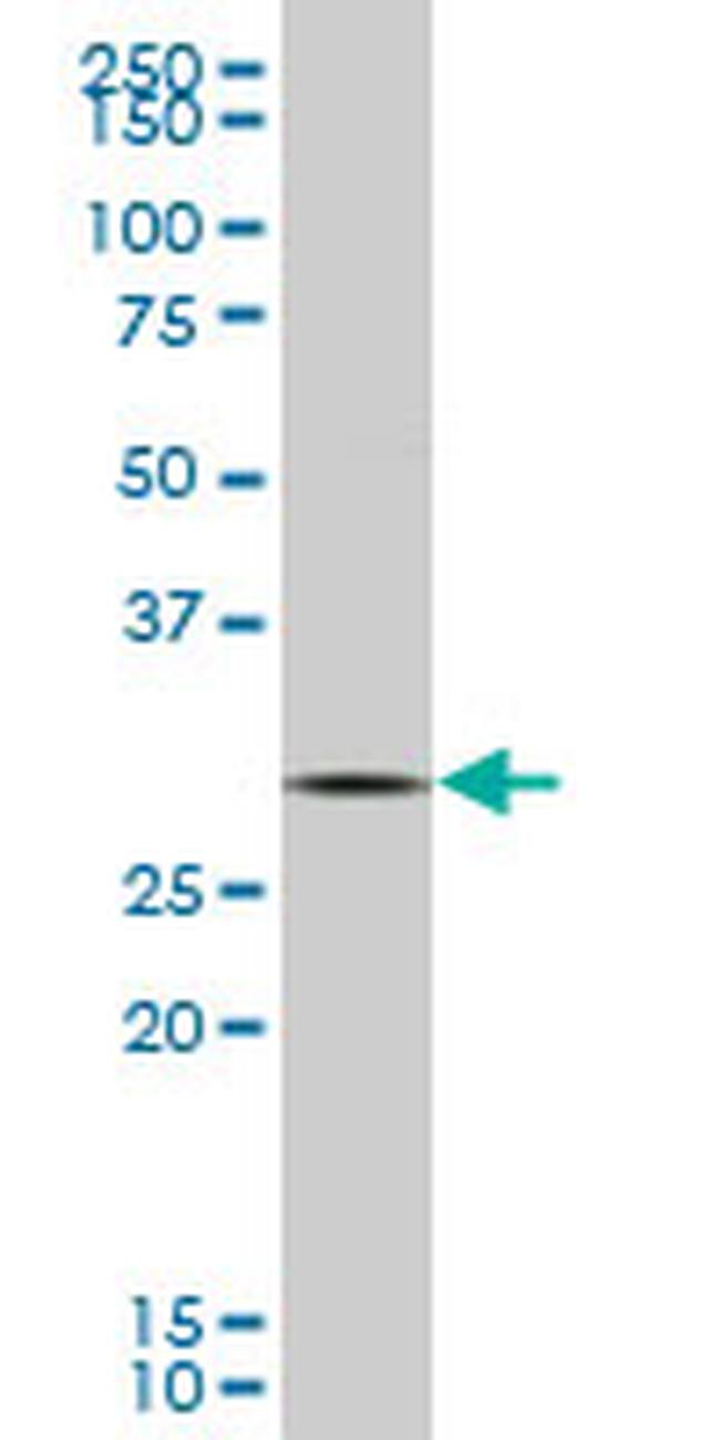 GCLM Antibody in Western Blot (WB)