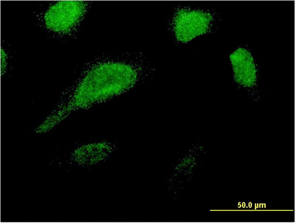 GLE1 Antibody in Immunocytochemistry (ICC/IF)