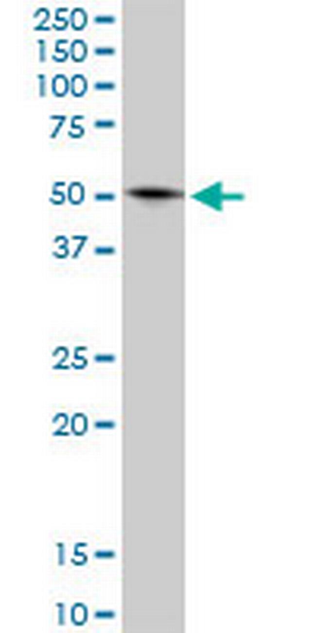 GLUD2 Antibody in Western Blot (WB)