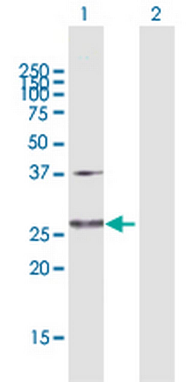GLUD2 Antibody in Western Blot (WB)